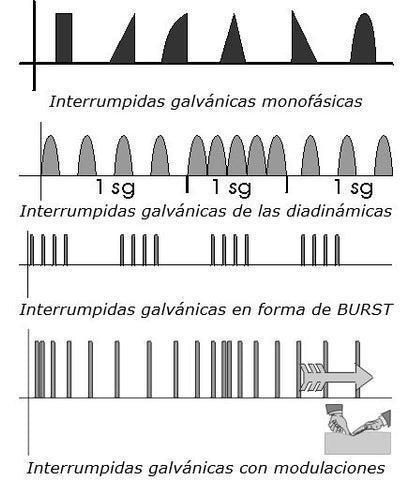 Formas de Onda 