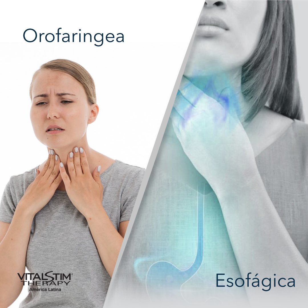 Orofaringea y Esofágica 